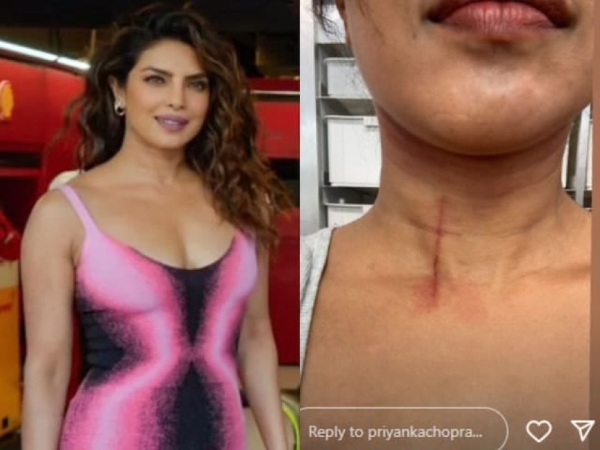 फिल्म द ब्लफ की सेट पर प्रियंका चोपड़ा को लगी चोट, सोशल मीडिया पर दी जानकारी।