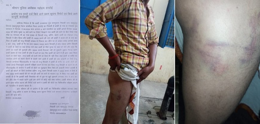 शिकायत करने गए पीड़ित को पुलिस ने थाने में बैठाया, आरोप- बेहोश होने तक दी थर्ड डिग्री, पीड़ित ने एसपी से की शिकायत.