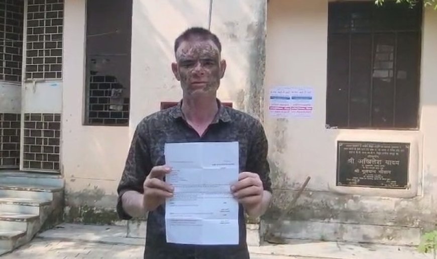  बिजनौर न्यूज़: साहब मैं जिंदा हूं...मुझे मृत घोषित कर दिया है- जिंदा व्यक्ति को कर दिया मृत्यु घोषित, विद्युत विभाग के बड़ी लापरवाही। 