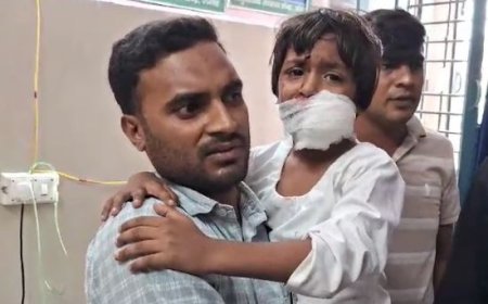 Saharanpur News: दो सगी बहनों समेत चार बच्चों को कुत्ते ने नोंचा