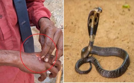 Deoband: युवक के पीछे पड़ी नागिन, चार बार डंसा, सपेरे को बुलाकर पकड़वाया तो उसे भी काटा,