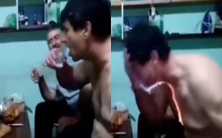 Viral News: शराब पीने के दौरान लग रहे थे फायर शॉट पैक, फिर अचानक हुआ कुछ ऐसा, पड़ गए लेने के देने।