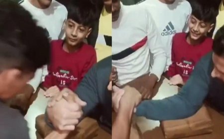 Viral News: पंजा लड़ाने के शोक में शख्स के हाथ का हुआ ऐसा हाल देखने वालों के उड़ गए होश। 