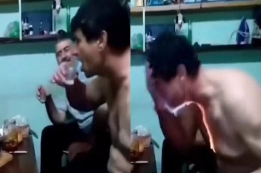Viral News: शराब पीने के दौरान लग रहे थे फायर शॉट पैक, फिर अचानक हुआ कुछ ऐसा, पड़ गए लेने के देने।
