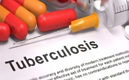 यूपी ने बाजी मारी, टीबी नोटिफिकेशन में देश में अव्वल, 6.5 लाख मरीजों को पंजीकृत करने के लक्ष्य के सापेक्ष 6.73 लाख मरीज हुए चिंहित