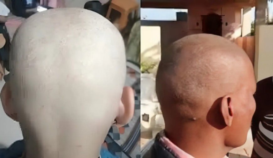 Ajab Gajab News: आखिर ऐसा क्या हुआ की 3 दिन में गंजे हो गये 60 लोग, डॉक्टर्स की टीम जांच में जुटी, कहीं वायरस के इफेक्ट्स तो नहीं, पढिये पूरी रिपोर्ट