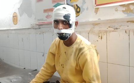Hardoi News: हैल्लो बोलते ही ब्लास्ट (Blast) हुआ मोबाइल (Mobile), गंभीर घायलों को अस्पताल में भर्ती करवाया, घटना से सब हैरान