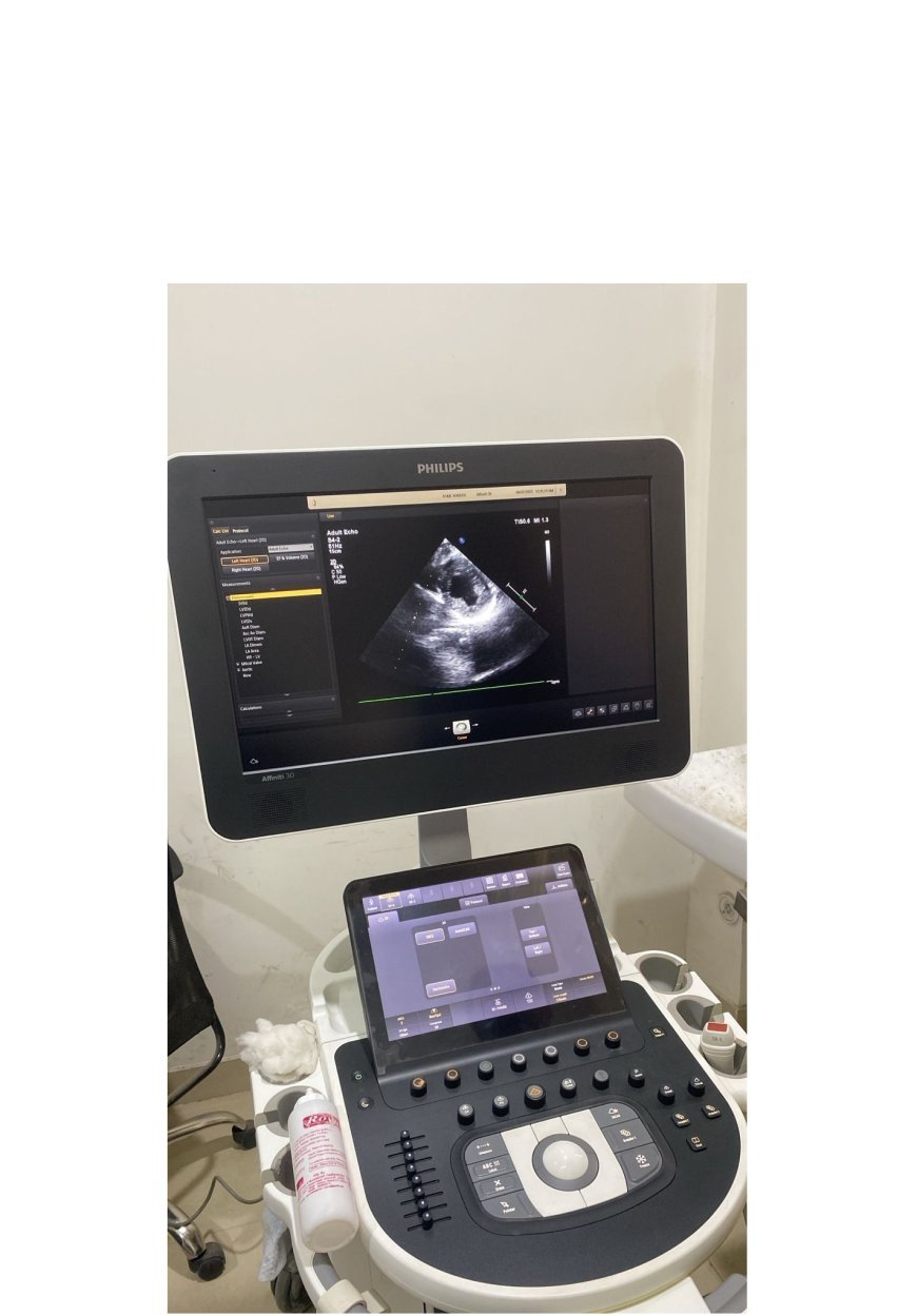 Hardoi News: Medical College में हृदय रोगियों हेतु इको परीक्षण (Cardiac Echocardiography) की शुरुआत