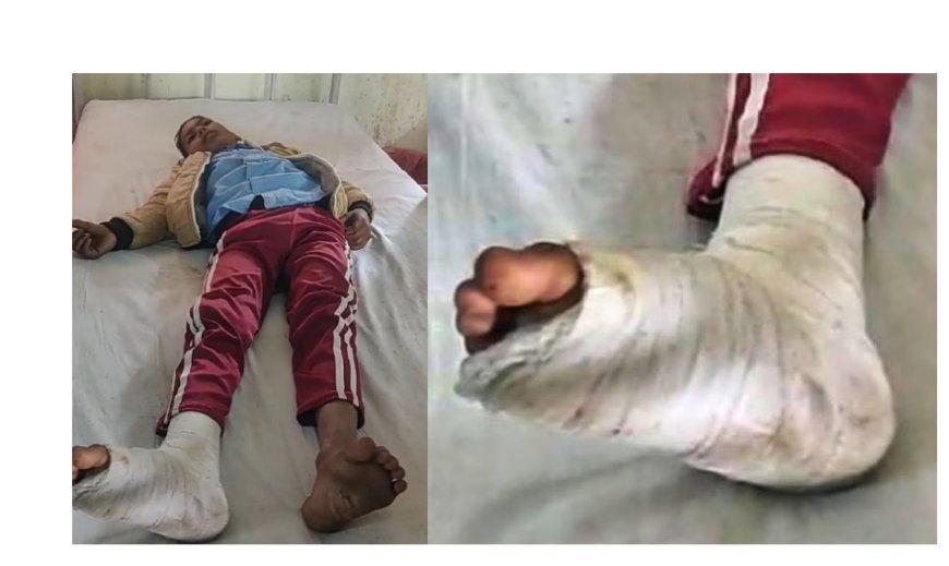 Hardoi News: बच्चे को मुर्गा बनाया और फिर उसके ऊपर बैठ गया शिक्षक, पढ़िए एक स्कूल में मासूम के साथ हुयी हैवानियत की सच्चाई