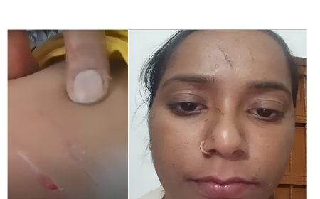 Hardoi News: शिक्षिका ने प्रधानाध्यापिका पर चाकू से हमला किया, मेज पर पैर रखने से मना करने पर किया हमला