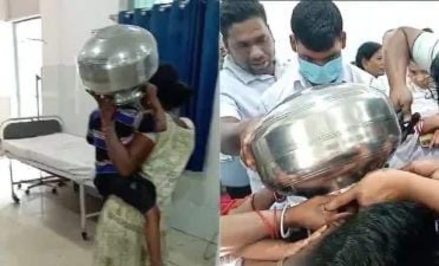 Viral News: खेलते-खेलते 4 साल के बच्चे के सिर में फंस गया बर्तन, फिर डॉक्टरों ने ऐसे बचाई जान। 