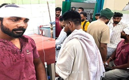 UK News: इटव्वा चौराहे पर तीन दबंगों ने लाठी डंडों व लोहे की रॉड से  युवक पर किया जानलेवा हमला। 