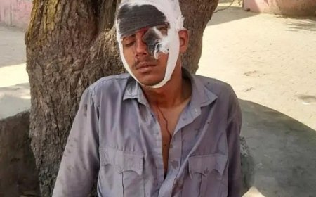 Deoband News: कॉलेज में हुई कहासुनी के बाद 12वीं कक्षा के छात्र के साथ मारपीट, सिर और आंख में लगी चोट, जिला अस्पताल रेफर। 