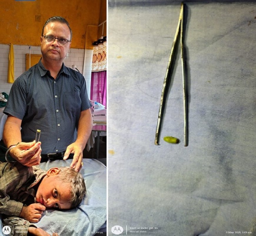 Hardoi News: बच्चों के कान में गई नीम की निंबोली, डॉक्टर ने ऑपरेशन कर कान से निकली, परिजनों ने कहा डॉक्टर हुए भगवान। 