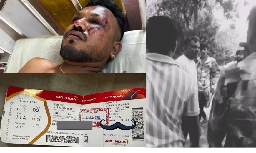 Ahemdabad News: 'जाको राखे साइयाँ, मार सके न कोय'- अहमदाबाद प्लेन क्रैश में चमत्कारिक ढंग से जिंदा बचे रमेश विश्वास कुमार