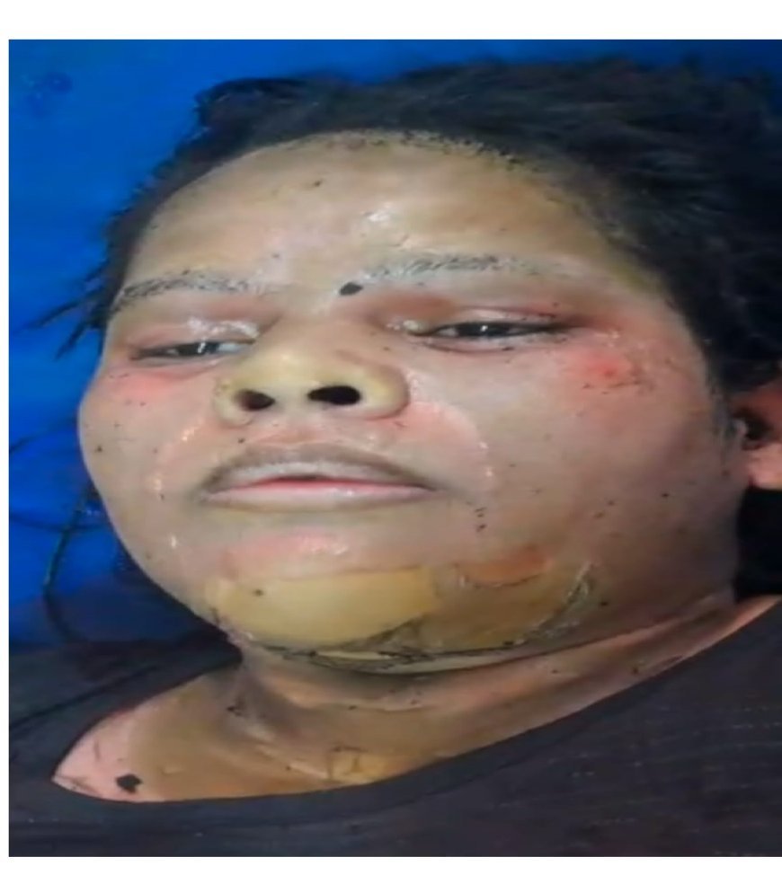 Hapur News : हापुड़ में पुरानी रंजिश का बदला, पड़ोसियों ने पुत्रवधु पर डाला ज्वलनशील पदार्थ, हालत गंभीर