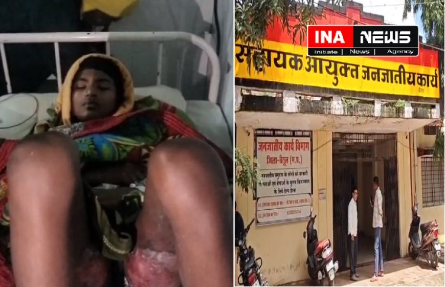 आदिवासी छात्रावास में सुरक्षा संकट: छात्रावास में आदिवासी छात्र को जलाने की कोशिश, अधीक्षक पर घटना दबाने का आरोप।