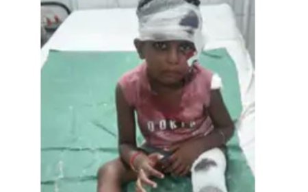 Sitapur : अनियंत्रित मोटरसाइकिल ने चार वर्षीय बच्ची को मारी टक्कर हुई घायल