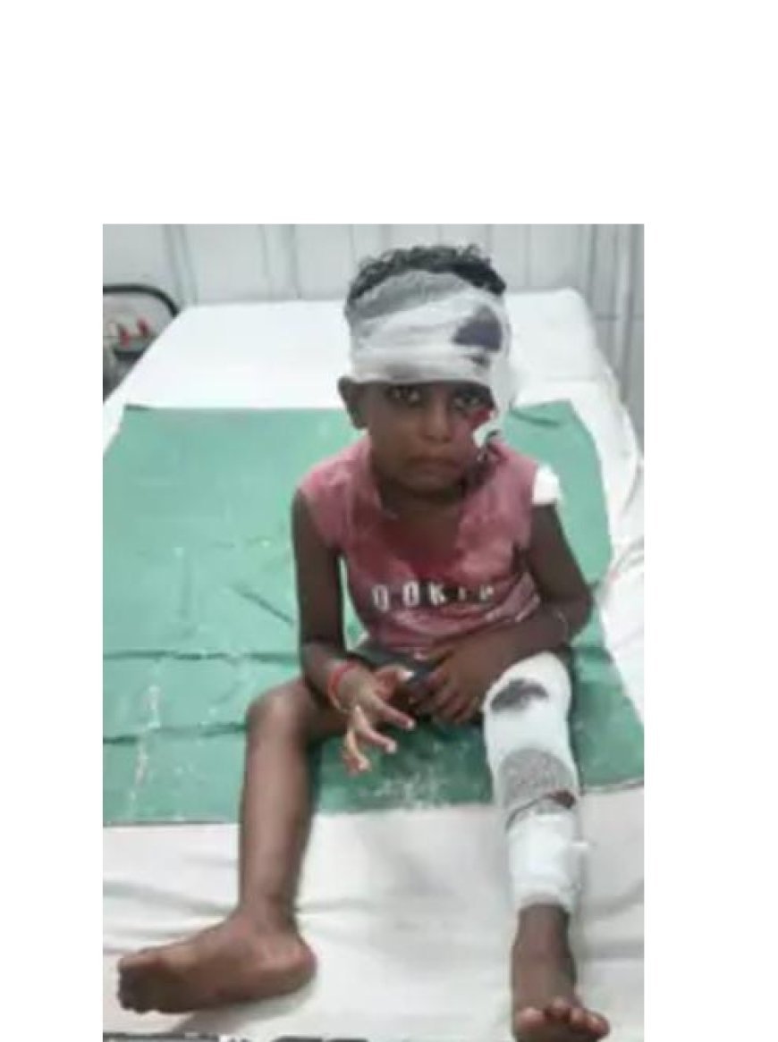 Sitapur : अनियंत्रित मोटरसाइकिल ने चार वर्षीय बच्ची को मारी टक्कर हुई घायल