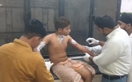 Sambhal: रुई की दुकान में भीषण आग, गैस रिफिलिंग के दौरान हादसे की आशंका, 15 साल का किशोर बुरी तरह झुलसा। 