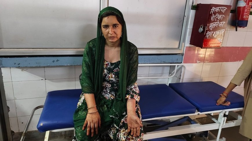 Sambhal: दहेज की मांग पर नवविवाहिता को तीन दिन तक कमरे में बंद कर बेरहमी से पीटा।