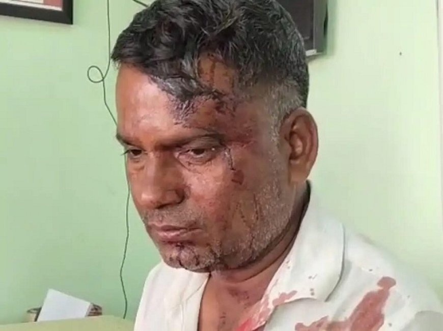 Deoband: बेटी से छेड़छाड़ की रंजिश में पिता पर फावड़े से हमला,पिता घायल।