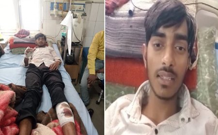 Hardoi:  दुर्गागंज गांव में हिंसा - हमीद पर गांव के चार लोगों का कुल्हाड़ी-बांका से जानलेवा हमला, पैर-हाथ में आई गंभीर चोटें।