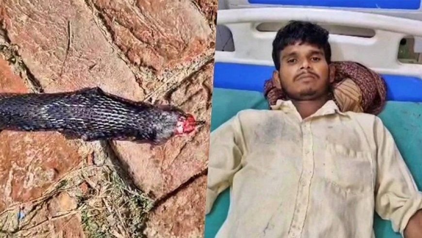 Hardoi: कोबरा के डसने पर गुस्से में युवक ने फन चबाकर मार डाला सांप, एक रात में ठीक होकर घर लौटा.