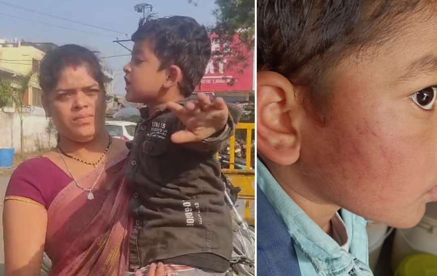 Madhya Pradesh: 3 साल के मासूम के साथ टीचर की मारपीट, स्कूल की मान्यता पर सवाल, BEO ने जांच दल बनाया, FIR दर्ज।