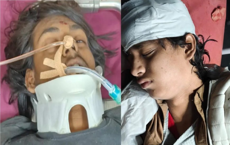 Hapur : दिल्ली-हापुड़ फ्लाईओवर पर बुलेट की टक्कर से दो युवक बुरी तरह जख्मी, एक नीचे गिरा