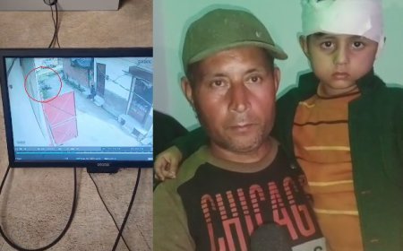 Deoband : देवबंद में आवारा कुत्तों का आतंक, स्कूल जा रहे दो भाइयों पर हमला, छोटा बच्चा गंभीर घायल