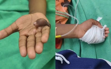 पंढरपुर में चिकित्सा लापरवाही का बड़ा मामला: डॉक्टर ने बच्चे के दाहिने हाथ के बजाय कर दी बाएं हाथ की सर्जरी।