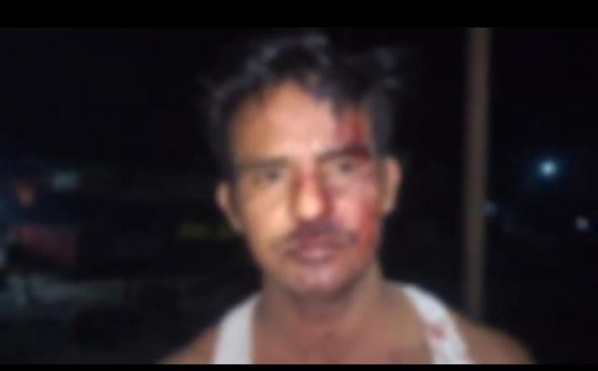 Sitapur : दो पक्षों के बीच खूनी संघर्ष, लाठी-डंडों और धारदार हथियारों से हमले में एक दर्जन से अधिक लोग घायल