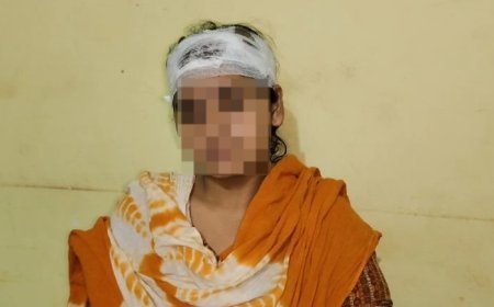 Sambhal: दहेज, सट्टा और हैवानियत: पति ने गड़ासे से किया हमला, इंसाफ के लिए दर-दर भटक रही पीड़िता। 