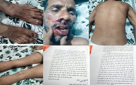 Saharanpur: बेहट पुलिस की 'थर्ड डिग्री' के आगे हैवानियत भी शर्मसार: स्टे के बावजूद आरिफ को दी तालिबानी सजा। 