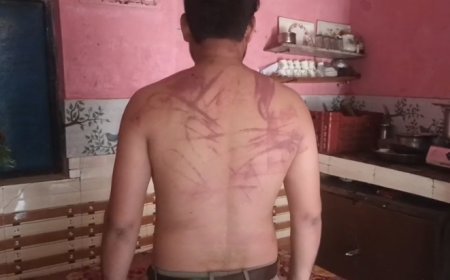 Sambhal : 500 रुपए के विवाद में युवक पर जानलेवा हमला, 15-16 लोगों ने बेल्टों और लात-घूसों से पीटा