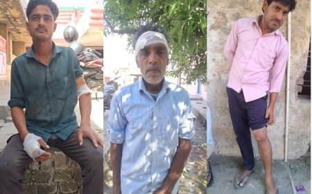 Lakhimpur- Kheri : सांप भगाने को लेकर दो पक्षों में खूनी संघर्ष, हमले में छह लोग घायल और लूट का आरोप