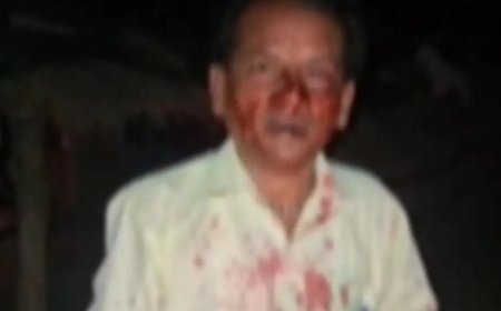 Gonda : गोण्डा में बुजुर्ग पर जानलेवा हमला और लूट, बदमाशों ने घेरकर पीटा, हालत गंभीर