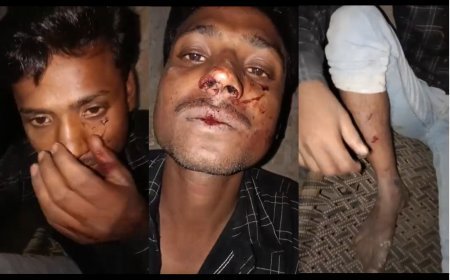Hardoi : कबाब पराठा खाने गए युवक पर हमला, पुलिस की सुस्त कार्रवाई पर उठाए सवाल