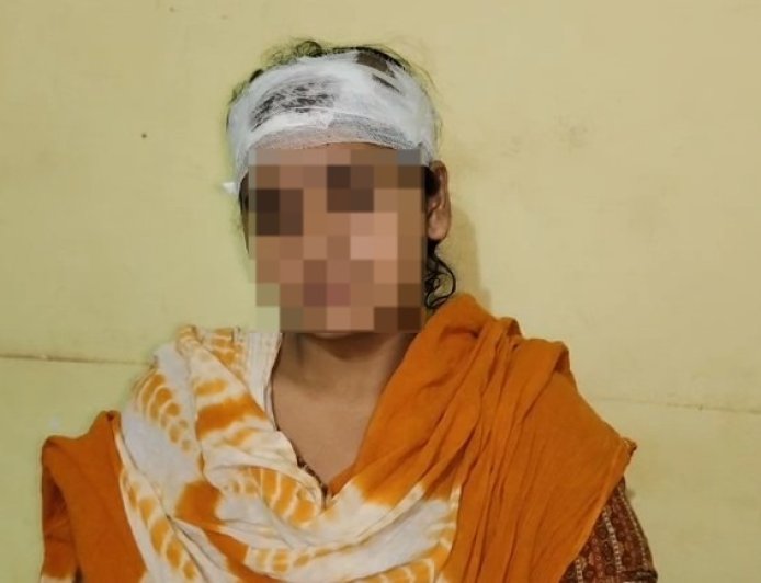 Sambhal: दहेज, सट्टा और हैवानियत: पति ने गड़ासे से किया हमला, इंसाफ के लिए दर-दर भटक रही पीड़िता। 