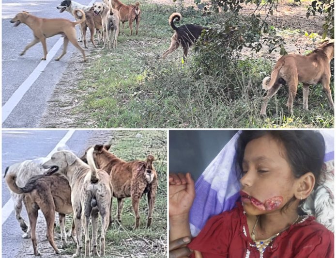 Saharanpur : छुटमलपुर में आवारा कुत्तों का आतंक, एक घंटे के भीतर पांच बच्चों को काटकर किया जख्मी