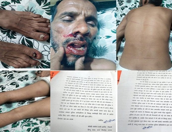 Saharanpur: बेहट पुलिस की 'थर्ड डिग्री' के आगे हैवानियत भी शर्मसार: स्टे के बावजूद आरिफ को दी तालिबानी सजा। 