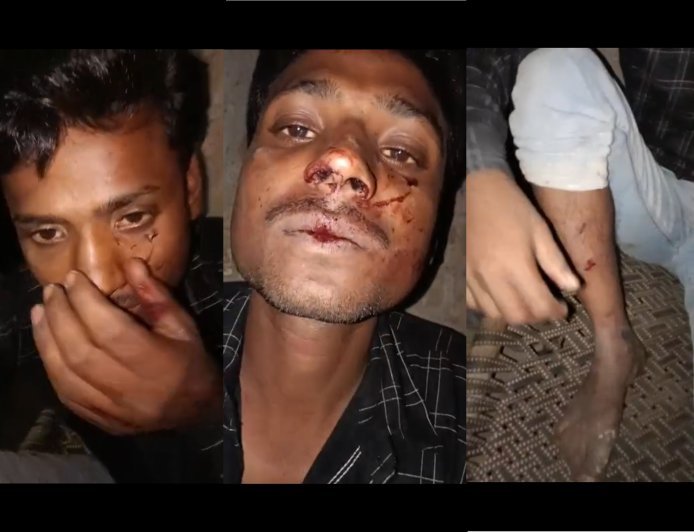 Hardoi : कबाब पराठा खाने गए युवक पर हमला, पुलिस की सुस्त कार्रवाई पर उठाए सवाल
