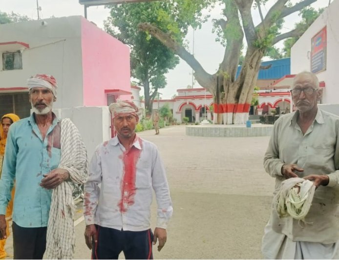 Saharanpur : खेत में आपसी विवाद में लाठी डंडों से हमला, दो युवक गंभीर घायल, सहारनपुर रेफर