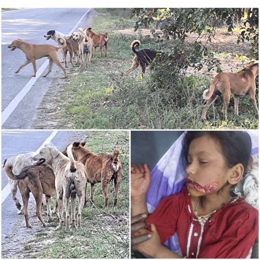Saharanpur : छुटमलपुर में आवारा कुत्तों का आतंक, एक घंटे के भीतर पांच बच्चों को काटकर किया जख्मी