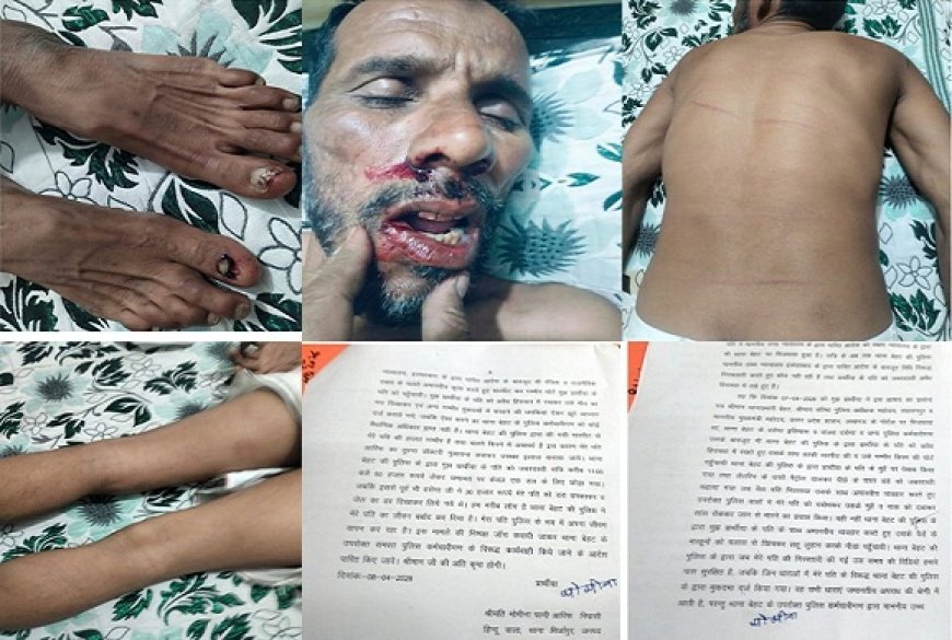 Saharanpur: बेहट पुलिस की 'थर्ड डिग्री' के आगे हैवानियत भी शर्मसार: स्टे के बावजूद आरिफ को दी तालिबानी सजा। 