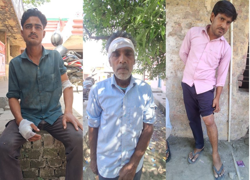 Lakhimpur- Kheri : सांप भगाने को लेकर दो पक्षों में खूनी संघर्ष, हमले में छह लोग घायल और लूट का आरोप