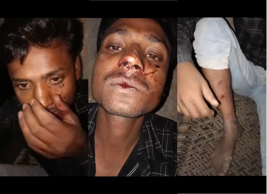 Hardoi : कबाब पराठा खाने गए युवक पर हमला, पुलिस की सुस्त कार्रवाई पर उठाए सवाल