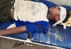 Hardoi : दो बाइकों की आमने-सामने भिड़ंत, दो युवक गंभीर रूप से घायल