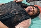 Deoband : बच्चों के विवाद की शिकायत करने गई महिला पर पड़ोसियों का हमला, हालत गंभीर होने पर बड़े अस्पताल रेफर